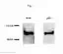 Fig. 02 - Methods and Compositions for Detecting Pancreatic Disease