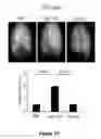 Fig. 43 - Method for therapeutic angiogenesis