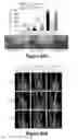 Fig. 44 - Method for therapeutic angiogenesis