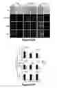 Fig. 46 - Method for therapeutic angiogenesis