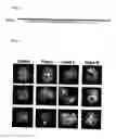 Fig. 03 - Phosphorylation-inhibiting agent or dephosphorylating agent for PTEN