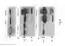 Fig. 10 - Pharmaceutical compositions comprising antibodies binding to the intracellular domain of EBV (Epstein-Barr virus) latent membrane protein-1 (LMP1)
