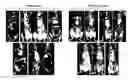 Fig. 01 - KINASE PROTEIN BINDING INHIBITORS