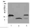 Fig. 01 - EGFR and PAR2 Regulation of Intestinal Permeability