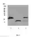 Fig. 02 - EGFR and PAR2 Regulation of Intestinal Permeability