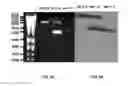 Fig. 11 - EGFR and PAR2 Regulation of Intestinal Permeability