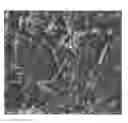 Fig. 01 - Composites of hydroxyapatite and calcium carbonate and related methods of preparation and use