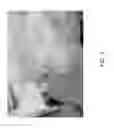 Fig. 04 - Apparatus for forming an implant