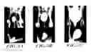 Fig. 04 - BLADDER RECONSTRUCTION