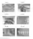 Fig. 07 - Bone graft and biocomposite for prosthetic dentistry