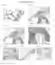 Fig. 12 - Bone graft and biocomposite for prosthetic dentistry