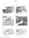 Fig. 13 - Bone graft and biocomposite for prosthetic dentistry