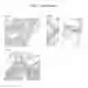 Fig. 14 - Bone graft and biocomposite for prosthetic dentistry