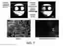 Fig. 08 - SYSTEMS AND METHODS OF TEMPLATING USING PARTICLES SUCH AS COLLOIDAL PARTICLES
