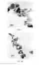 Fig. 26 - Hydroxyapatite poly(etheretherketone) nanocomposites and method of manufacturing same