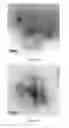 Fig. 28 - Hydroxyapatite poly(etheretherketone) nanocomposites and method of manufacturing same