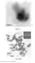 Fig. 29 - Hydroxyapatite poly(etheretherketone) nanocomposites and method of manufacturing same