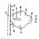 Fig. 03 - Skull mounting apparatus