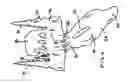 Fig. 05 - Skull mounting apparatus