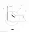 Fig. 03 - Localized Induction Heating For Residual Stress Optimization