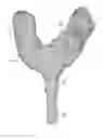 Fig. 01 - METHOD FOR PREPARING A SURGICAL MASK FOR THE INSTALLATION OF DENTAL IMPLANTS