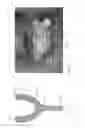 Fig. 02 - METHOD FOR PREPARING A SURGICAL MASK FOR THE INSTALLATION OF DENTAL IMPLANTS