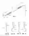 Fig. 02 - AREA-SPECIFIC DENTAL INSTRUMENT