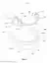 Fig. 02 - Removable Partial Dental Prosthesis