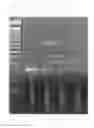 Fig. 04 - Highly sensitive method for the detection of cytosine methylation patterns