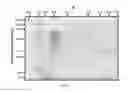 Fig. 06 - Reagents for biomolecular labeling, detection and quantification employing raman spectroscopy