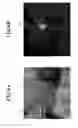 Fig. 07 - Method for detecting afferent lymph vessel inflow regions and method for identifying specific cells
