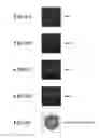 Fig. 10 - Method for detecting afferent lymph vessel inflow regions and method for identifying specific cells
