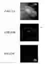 Fig. 14 - Method for detecting afferent lymph vessel inflow regions and method for identifying specific cells