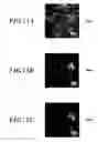 Fig. 16 - Method for detecting afferent lymph vessel inflow regions and method for identifying specific cells
