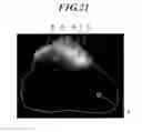 Fig. 22 - Method for detecting afferent lymph vessel inflow regions and method for identifying specific cells
