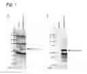 Fig. 02 - Method for detecting antibody against SITH-1 in biological sample