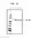 Fig. 13 - Methods and compositions for concentrating secreted recombinant protein