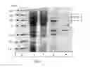Fig. 07 - Method for producing 4-hydroxy-L-isoleucine