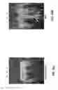 Fig. 43 - Endophytic yeast strains, methods for ethanol and xylitol production, methods for biological nitrogen fixation, and a genetic source for improvement of industrial strains