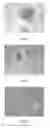 Fig. 02 - Method for obtaining human microglial precursor cells from pluripotent stem cells