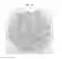 Fig. 15 - Microorganism culture sheet and manufacturing method therefor