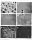 Fig. 02 - Human late stage motor neuron progenitor cells produced from pluripotent stem cells