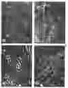 Fig. 03 - Human late stage motor neuron progenitor cells produced from pluripotent stem cells