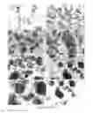 Fig. 05 - Cultured pancreas islets