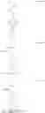 Fig. 08 - Edge Bead Remover For Coatings