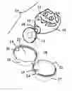 Fig. 01 - Suction cup character and capsule assembly
