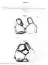 Fig. 05 - Supporting wire for a breast covering garment