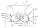 Fig. 01 - Adjustable push-up adhesive bra