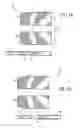 Fig. 11 - Ball bat including a barrel portion having separate proximal and distal members