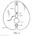 Fig. 08 - Exercise Apparatus With an Inertia System